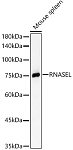 Western blot - RNASEL Rabbit pAb (A9840)