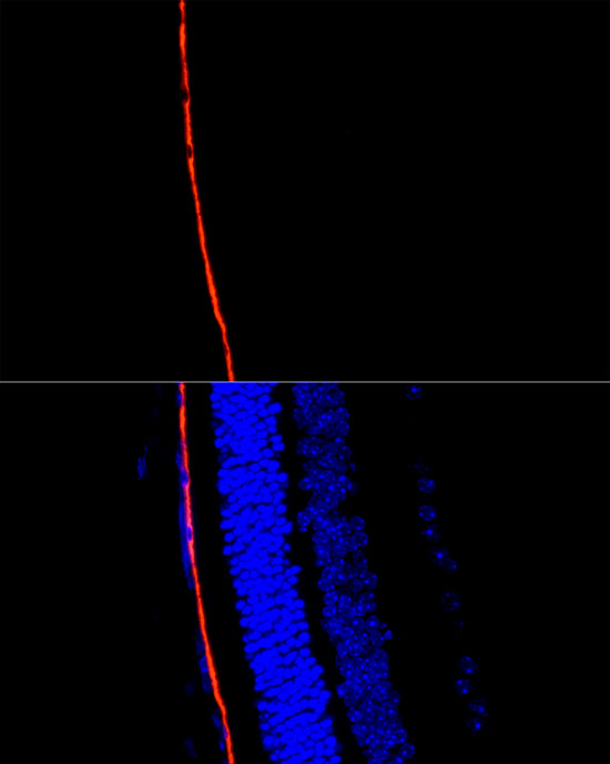 RPE65 Rabbit polyclonal antibody