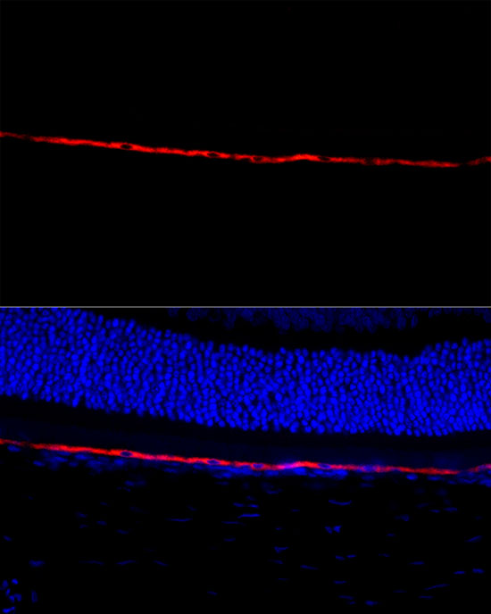 RPE65 Rabbit polyclonal antibody