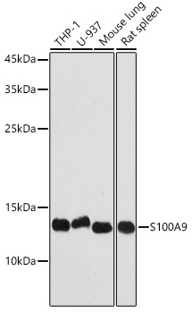 S100A9 Rabbit polyclonal antibody