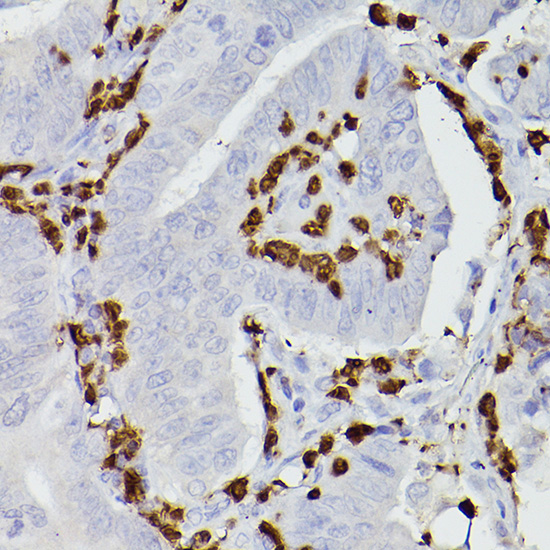 S100A9 Rabbit polyclonal antibody