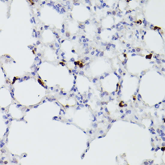S100A9 Rabbit polyclonal antibody
