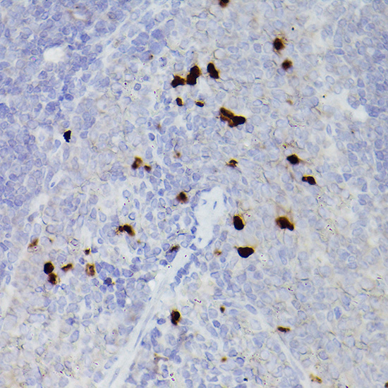 S100A9 Rabbit polyclonal antibody