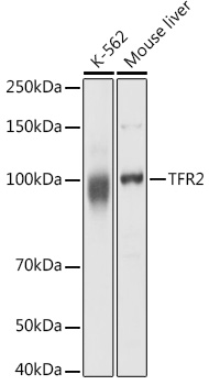 TFR2 Rabbit polyclonal antibody