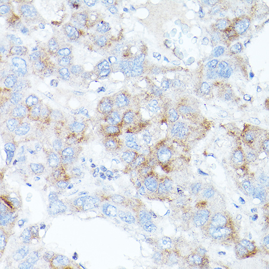 TFR2 Rabbit polyclonal antibody
