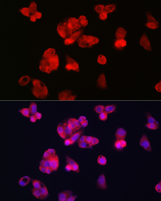 TFR2 Rabbit polyclonal antibody