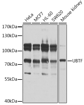 UBTF Rabbit polyclonal antibody