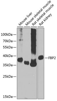 FBP2 Rabbit polyclonal antibody