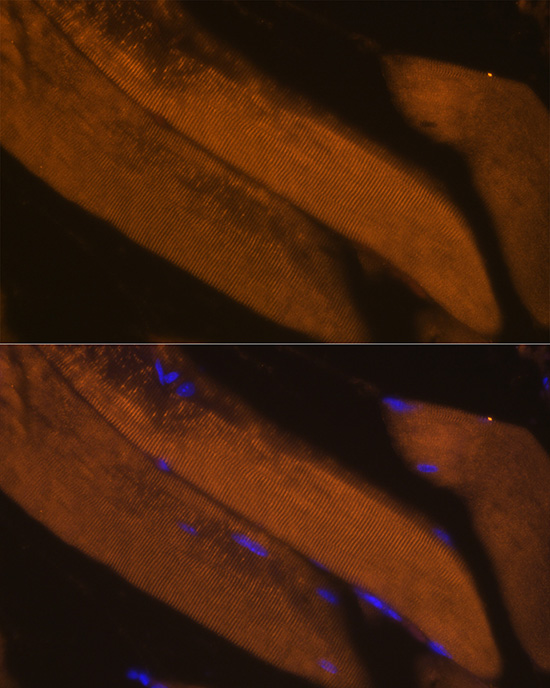 FBP2 Rabbit polyclonal antibody