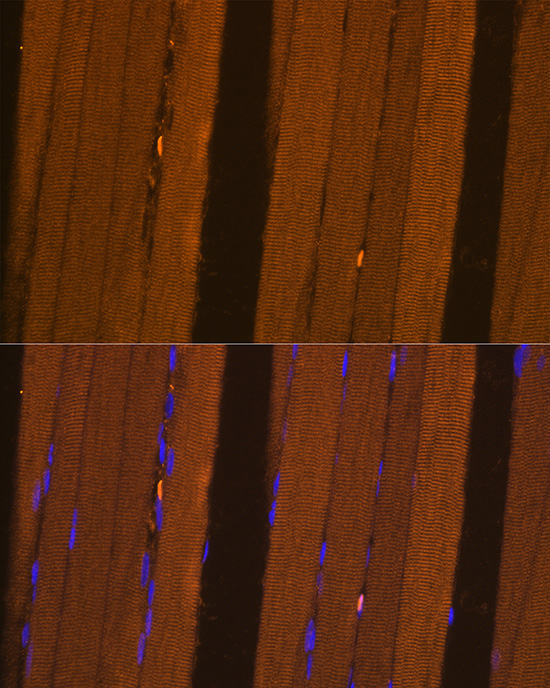FBP2 Rabbit polyclonal antibody