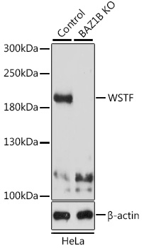 [KO Validated] WSTF Rabbit polyclonal antibody