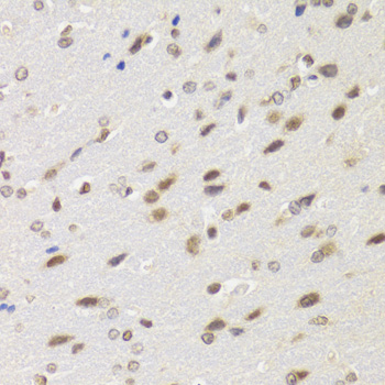 [KO Validated] WSTF Rabbit polyclonal antibody