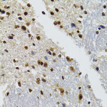 [KO Validated] WSTF Rabbit polyclonal antibody