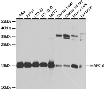 MRPS16 Rabbit polyclonal antibody
