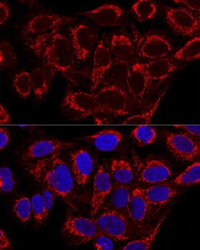MRPS16 Rabbit polyclonal antibody