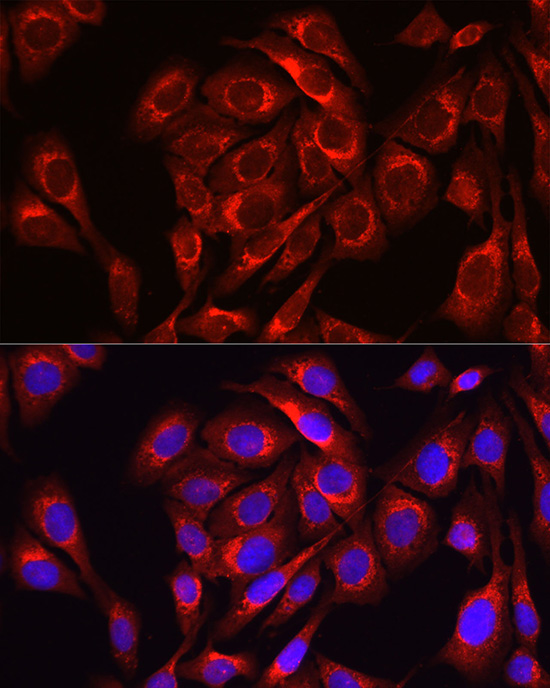 Mitofusin-1/MFN1 Rabbit polyclonal antibody