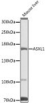 Western blot - ASXL1 Rabbit pAb (A9890)