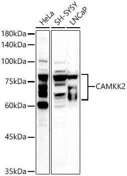 CAMKK2 Rabbit polyclonal antibody