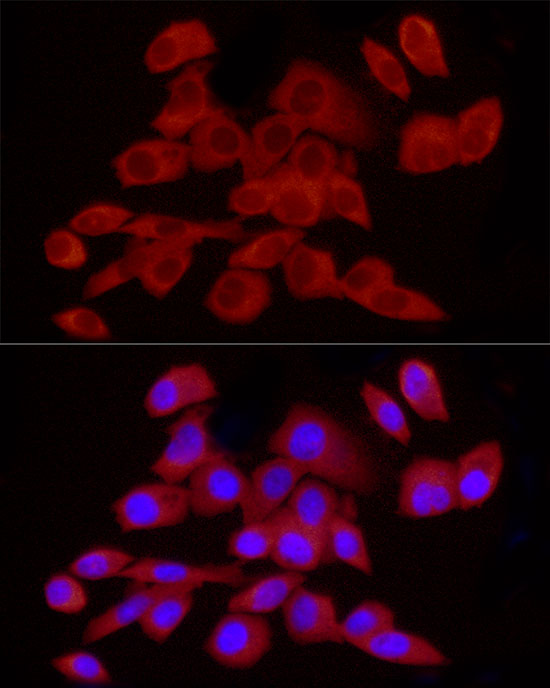 CAMKK2 Rabbit polyclonal antibody