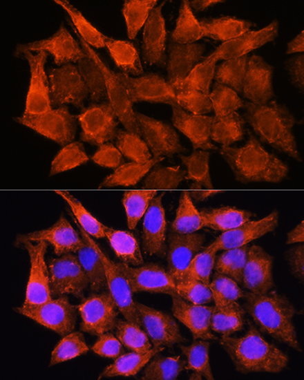 AMT Rabbit polyclonal antibody
