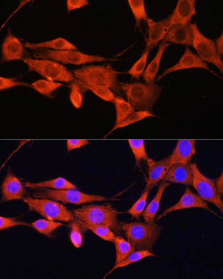 AMT Rabbit polyclonal antibody
