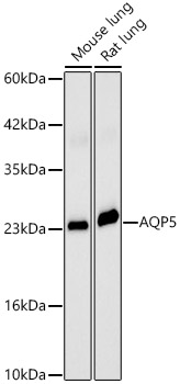 AQP5 Rabbit polyclonal antibody