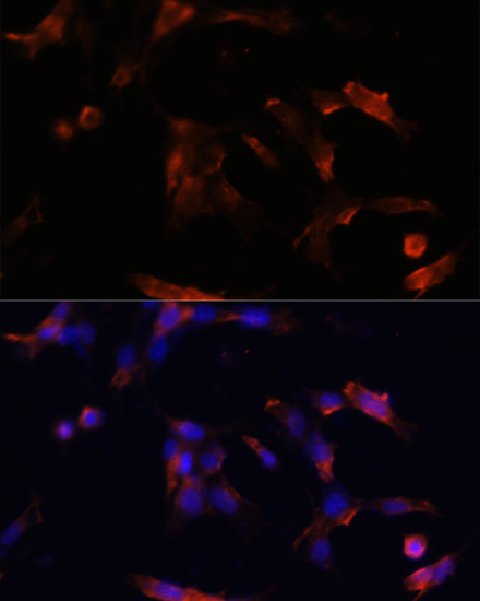 AQP5 Rabbit polyclonal antibody