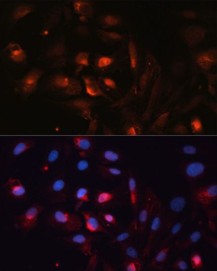AQP5 Rabbit polyclonal antibody