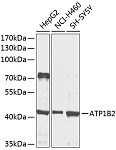 Western blot - ATP1B2 Rabbit pAb (A9928)