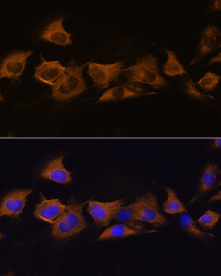 ATP1B2 Rabbit polyclonal antibody