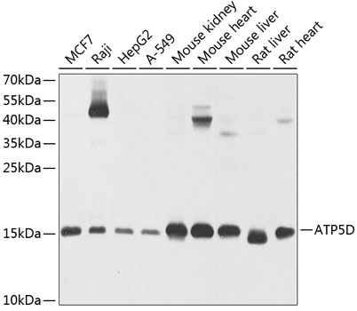 ATP5D Rabbit polyclonal antibody