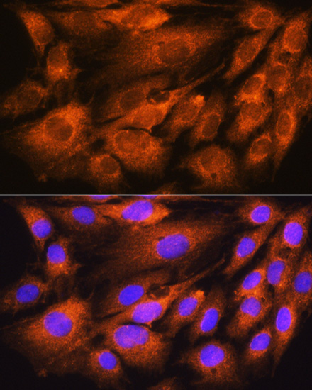 ATP5D Rabbit polyclonal antibody
