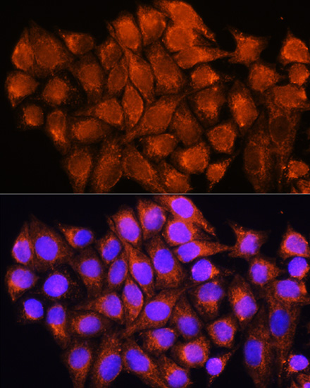 ATP5D Rabbit polyclonal antibody
