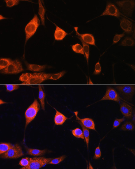 ATP5D Rabbit polyclonal antibody