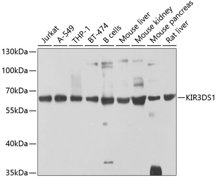 KIR3DS1 Rabbit polyclonal antibody