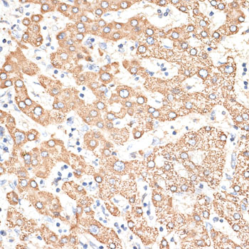 KIR3DS1 Rabbit polyclonal antibody