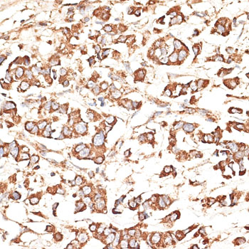 KIR3DS1 Rabbit polyclonal antibody