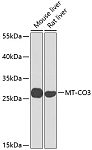 Western blot - MT-CO3 Rabbit pAb (A9939)