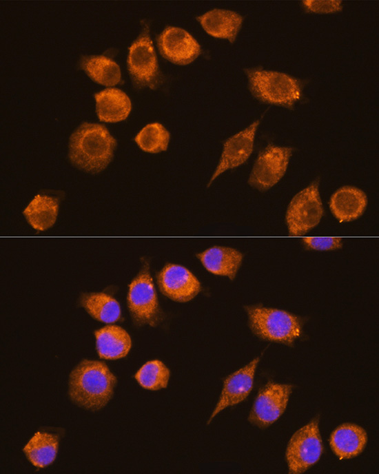 NAGA Rabbit polyclonal antibody