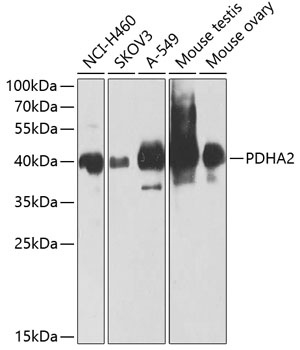 PDHA2 Rabbit polyclonal antibody