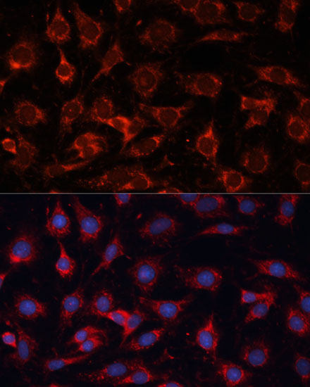 PDHA2 Rabbit polyclonal antibody