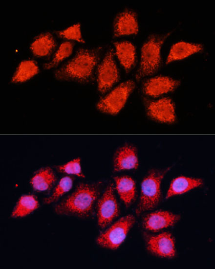 PDHA2 Rabbit polyclonal antibody
