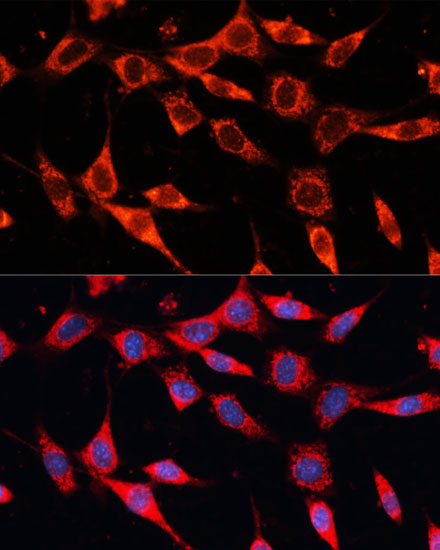 PDHA2 Rabbit polyclonal antibody