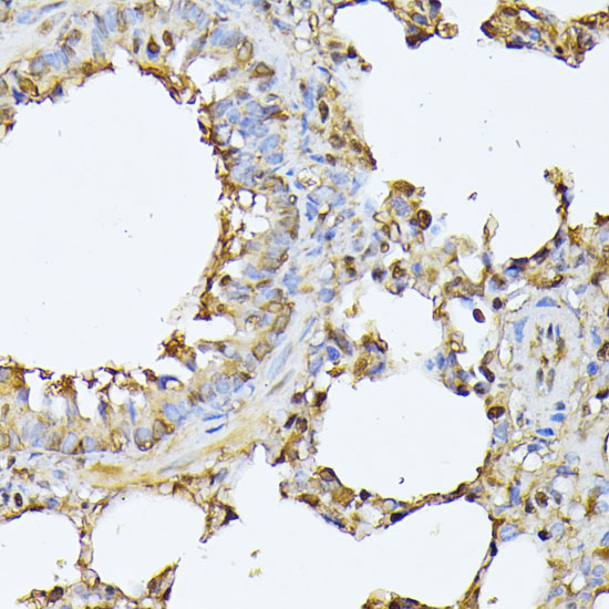 PSMB3 Rabbit polyclonal antibody