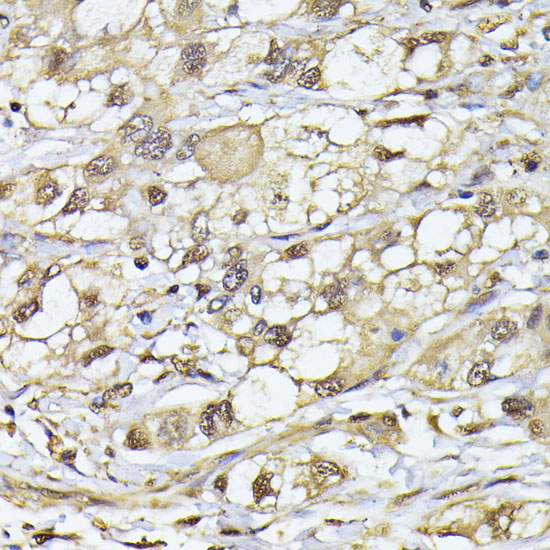 PSMB3 Rabbit polyclonal antibody