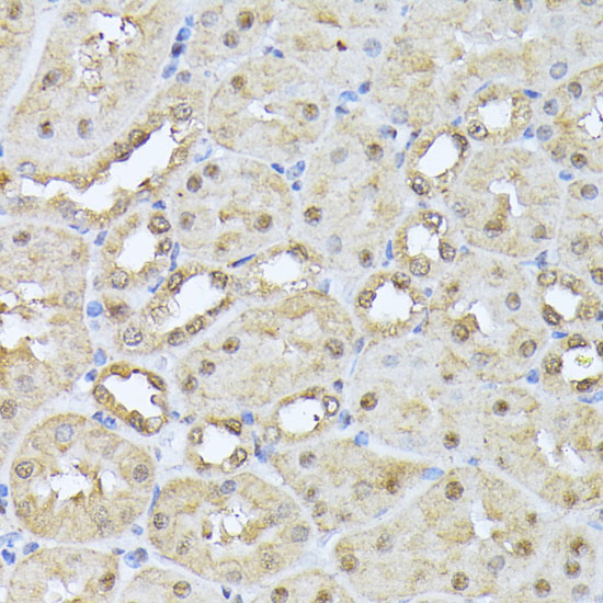 PSMB3 Rabbit polyclonal antibody