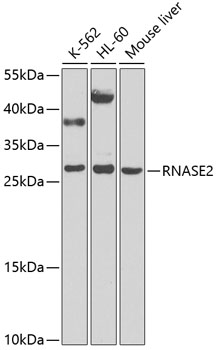 RNASE2 Rabbit polyclonal antibody