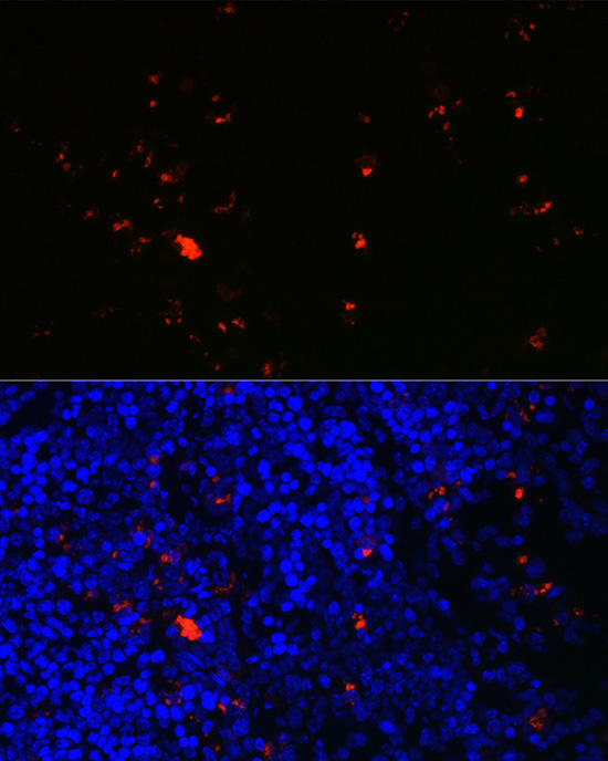 RNASE2 Rabbit polyclonal antibody