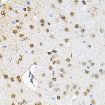 BAF60a Rabbit polyclonal antibody