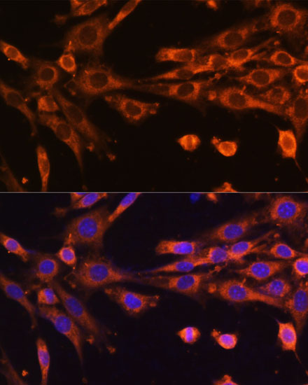 SUPV3L1 Rabbit polyclonal antibody